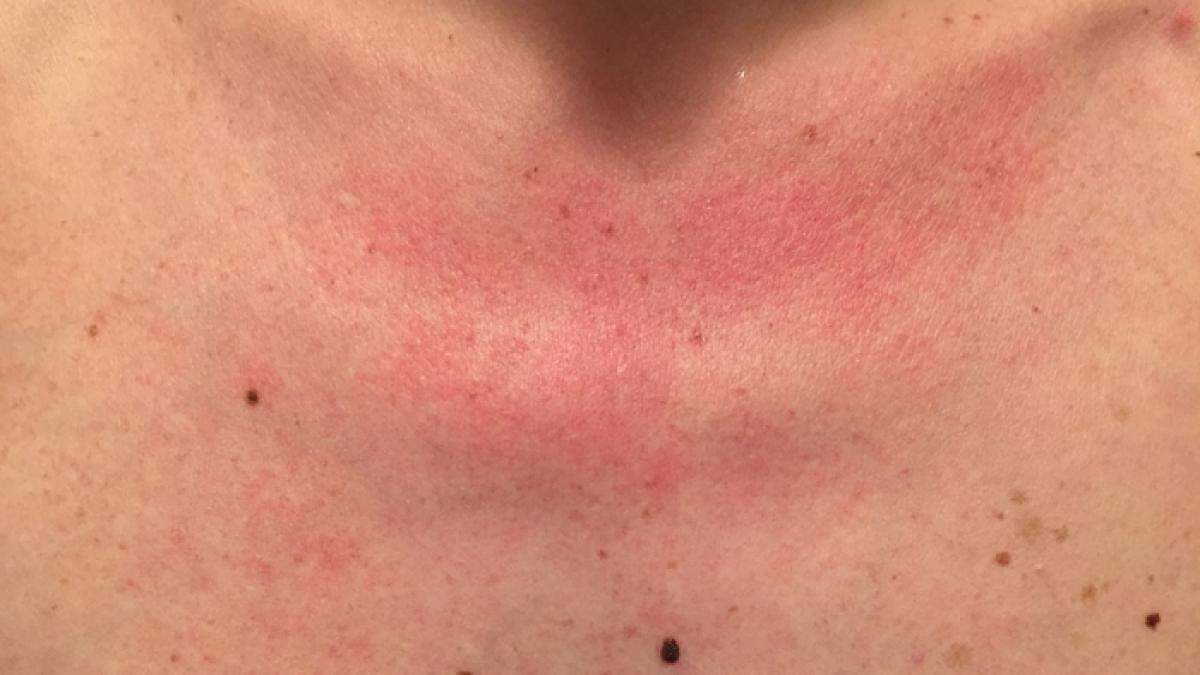 pete_rosii_piept_53006000