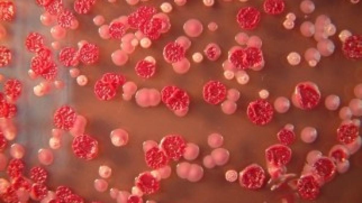 virusul_zika_avertizari_357645_21807000_20476100