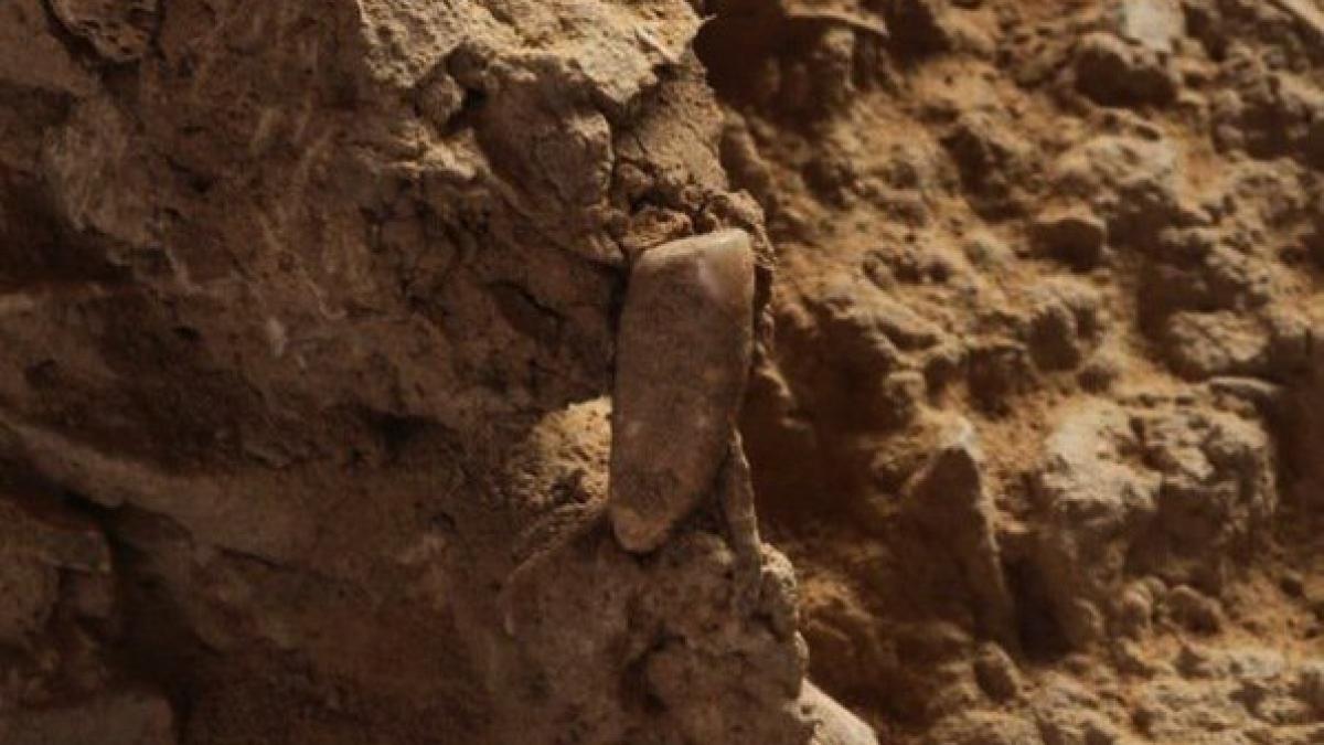 humantoothfrance1_38803200