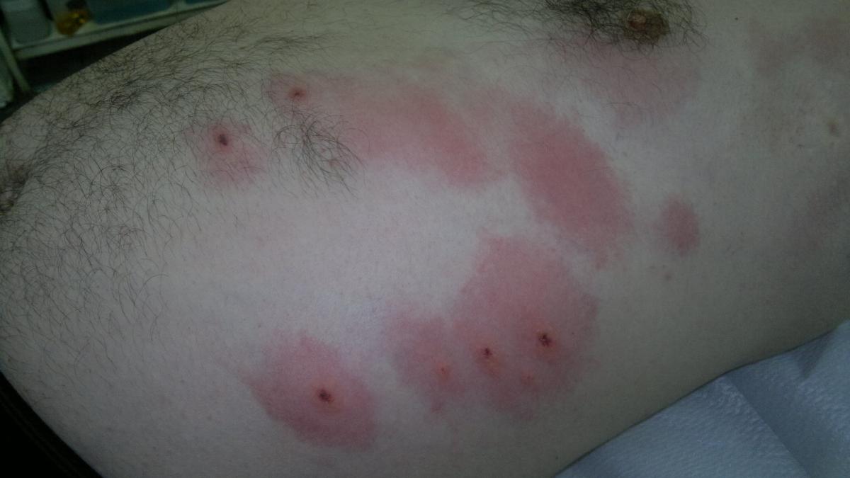 24052012720_72207000