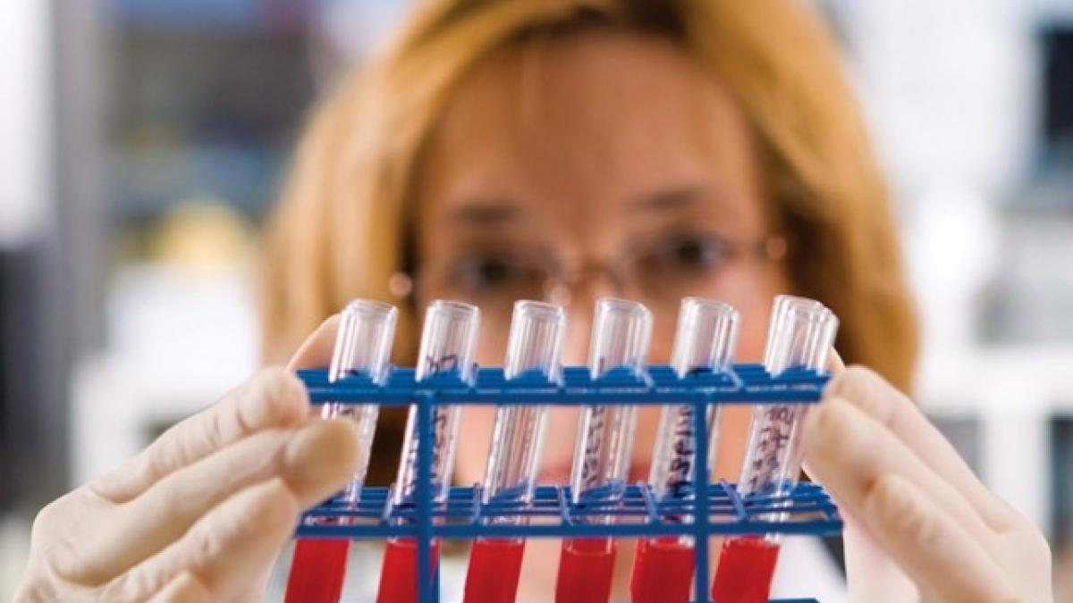 hepatita_c_laborator_97996200