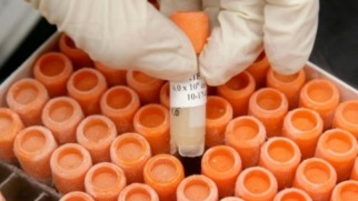 donator_celule_stem_41991200