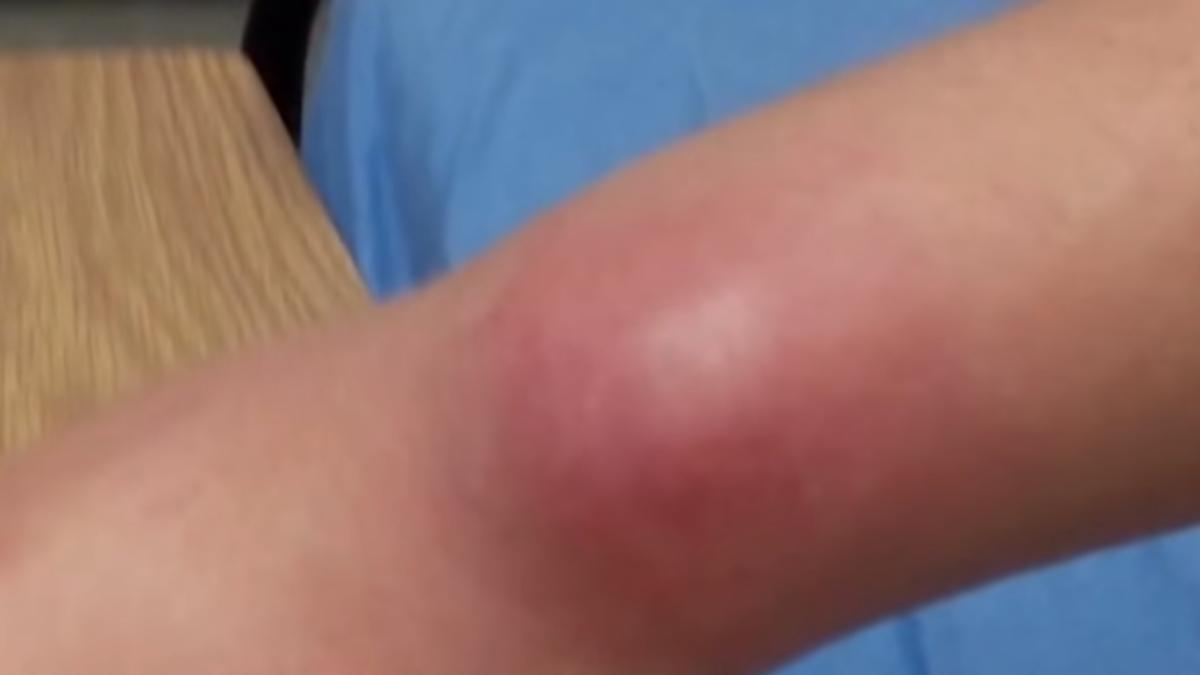 infectie_mana_42331200