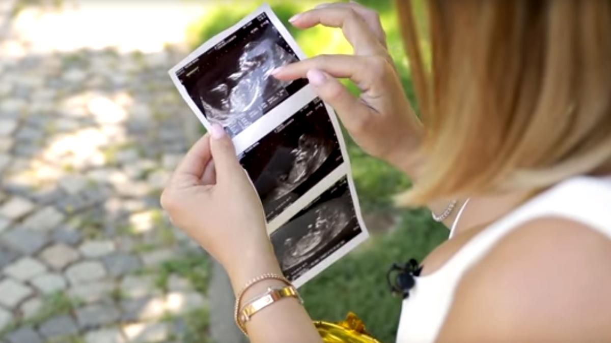 ela_craciun_ecografie_2_54041300