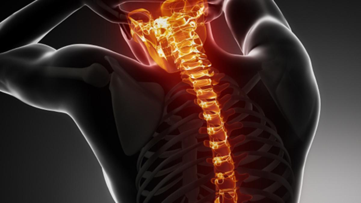 radiografie_22738500