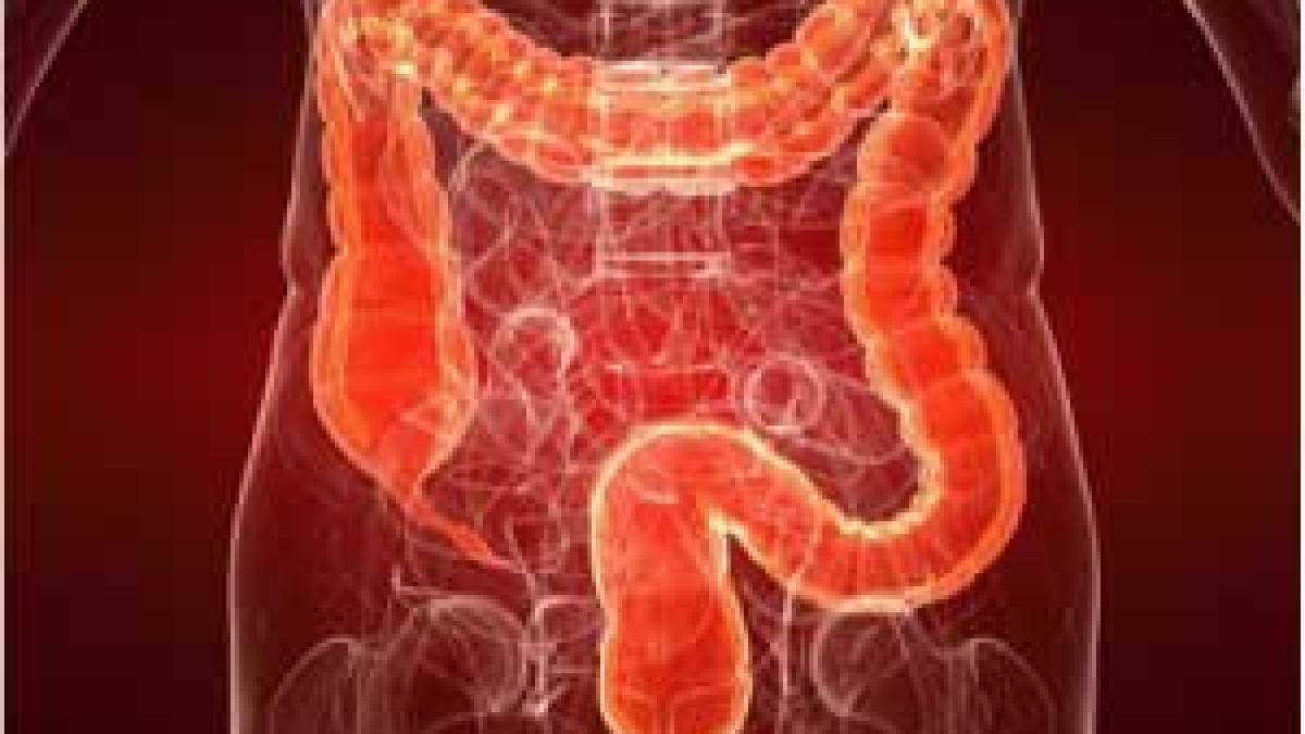 colon_cancer_22420000