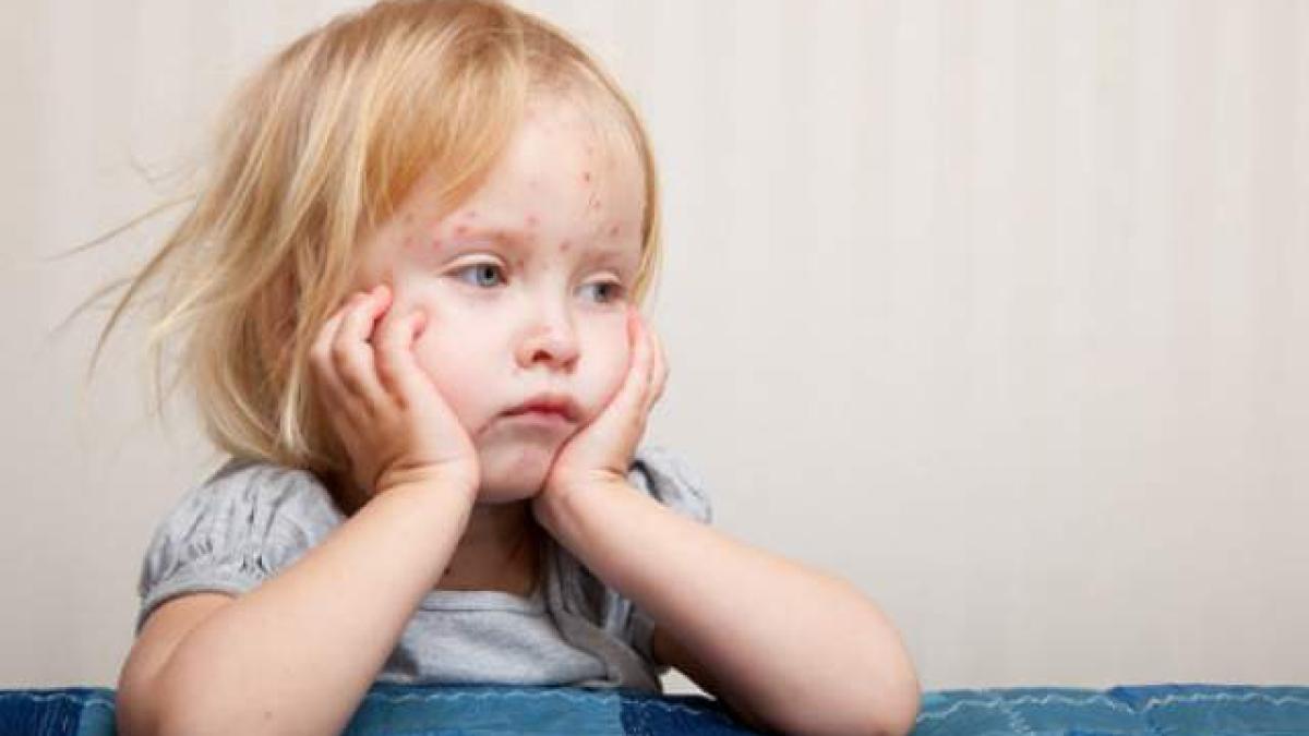 inca_14_copii_cu_rujeola_internati_in_spital_25473300