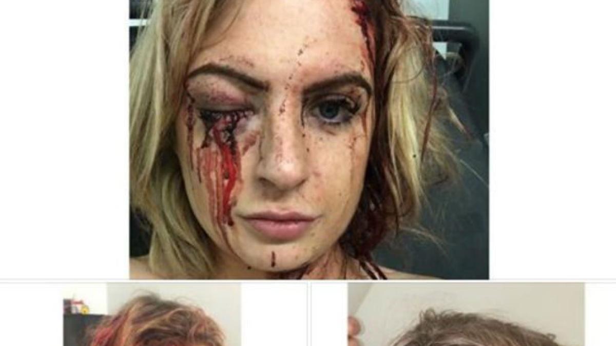 blythe-atac-the-sun_88057800