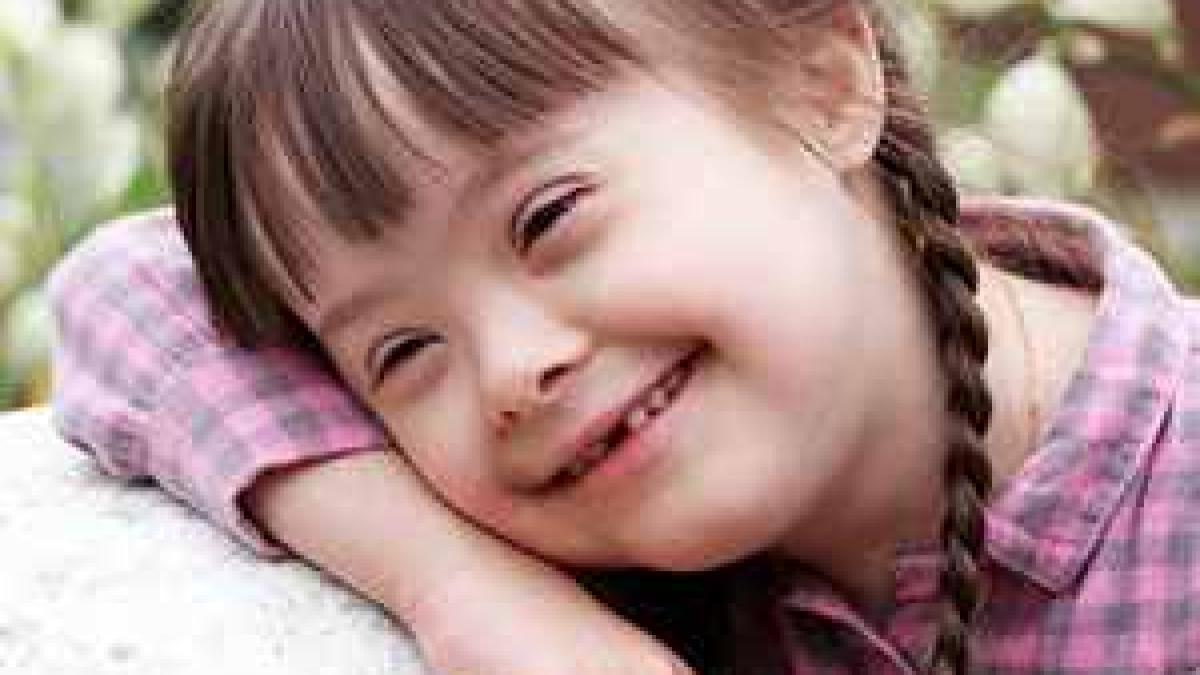 sindrom_down_23287100