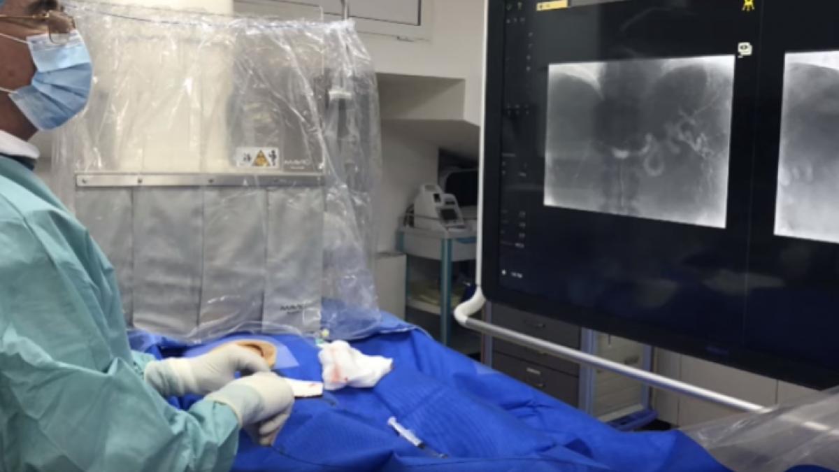 radiologie_interventionala_bogdan_popa_80047800_54342900