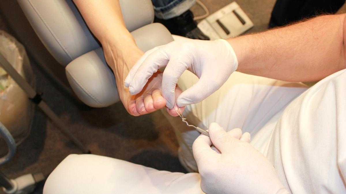 doctor_podiatru_picior_86901000