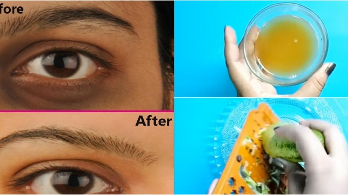 truc-cearcane_05797300