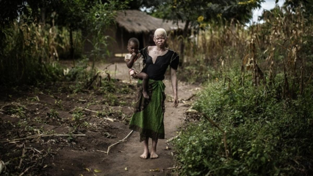 albinosi_96404100_11005500