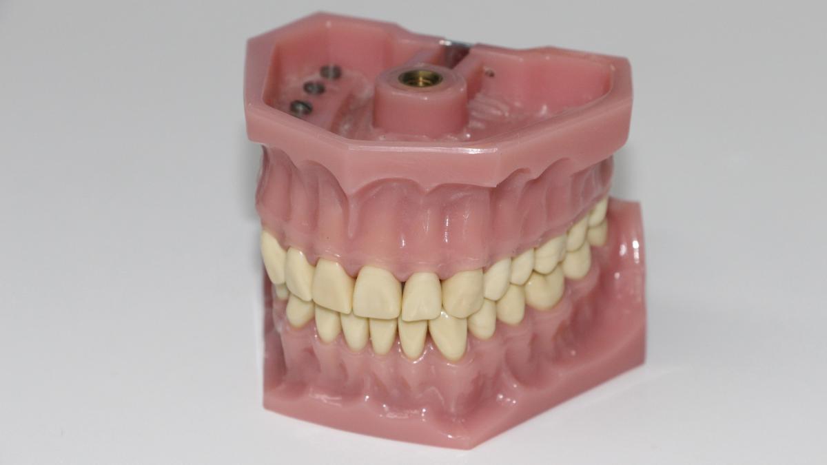 proteza-dentara_65490700