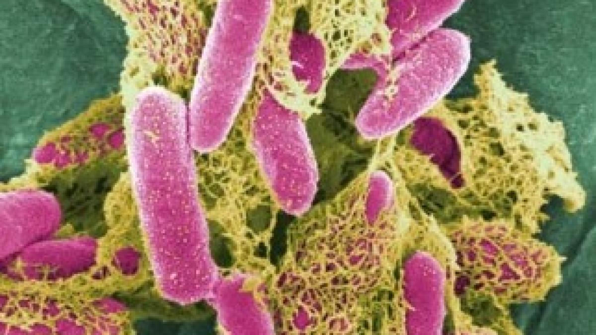 e.coli_2