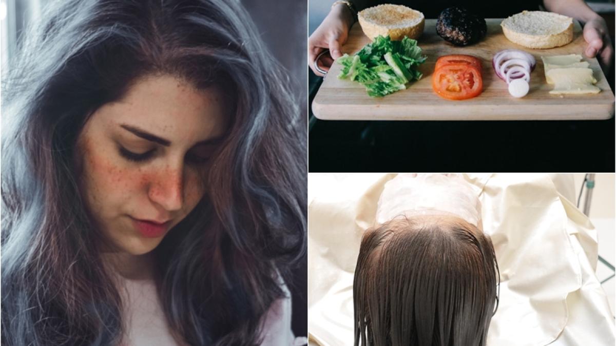 fire-par-alb_15924000