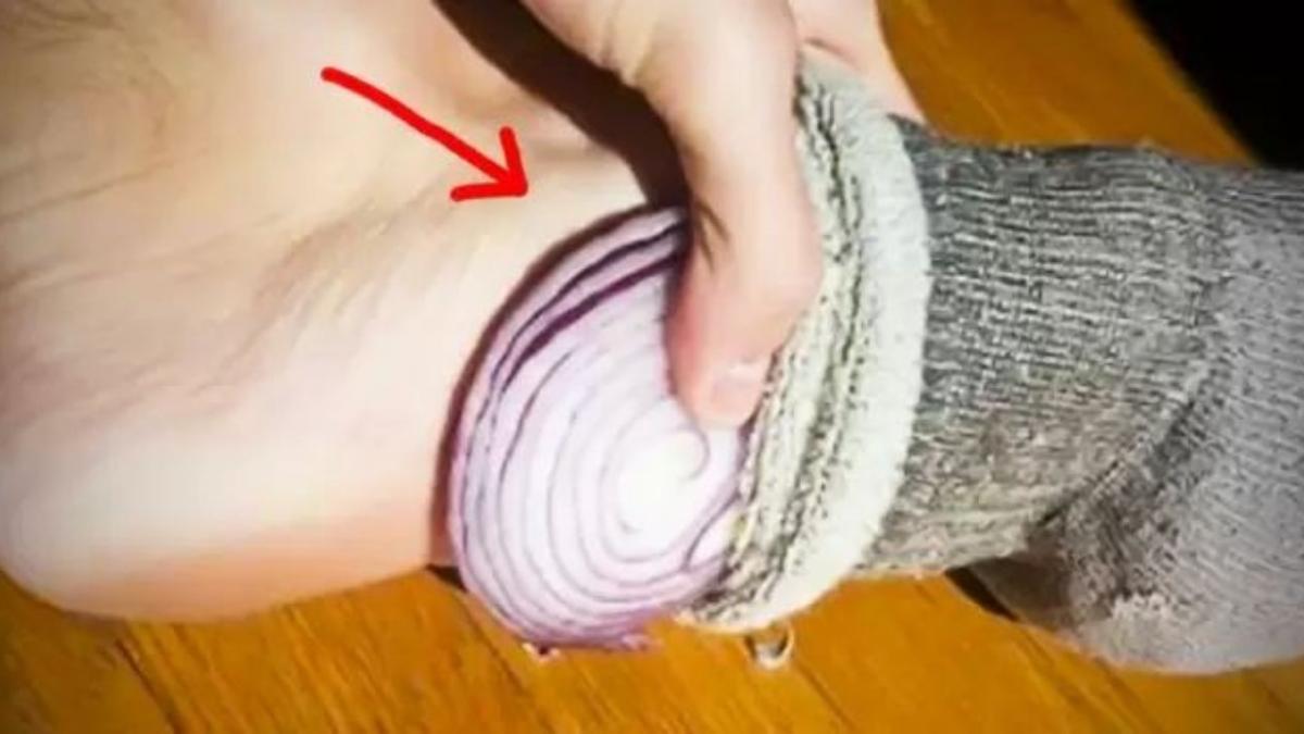 ceapa-pe-talpi_16043800