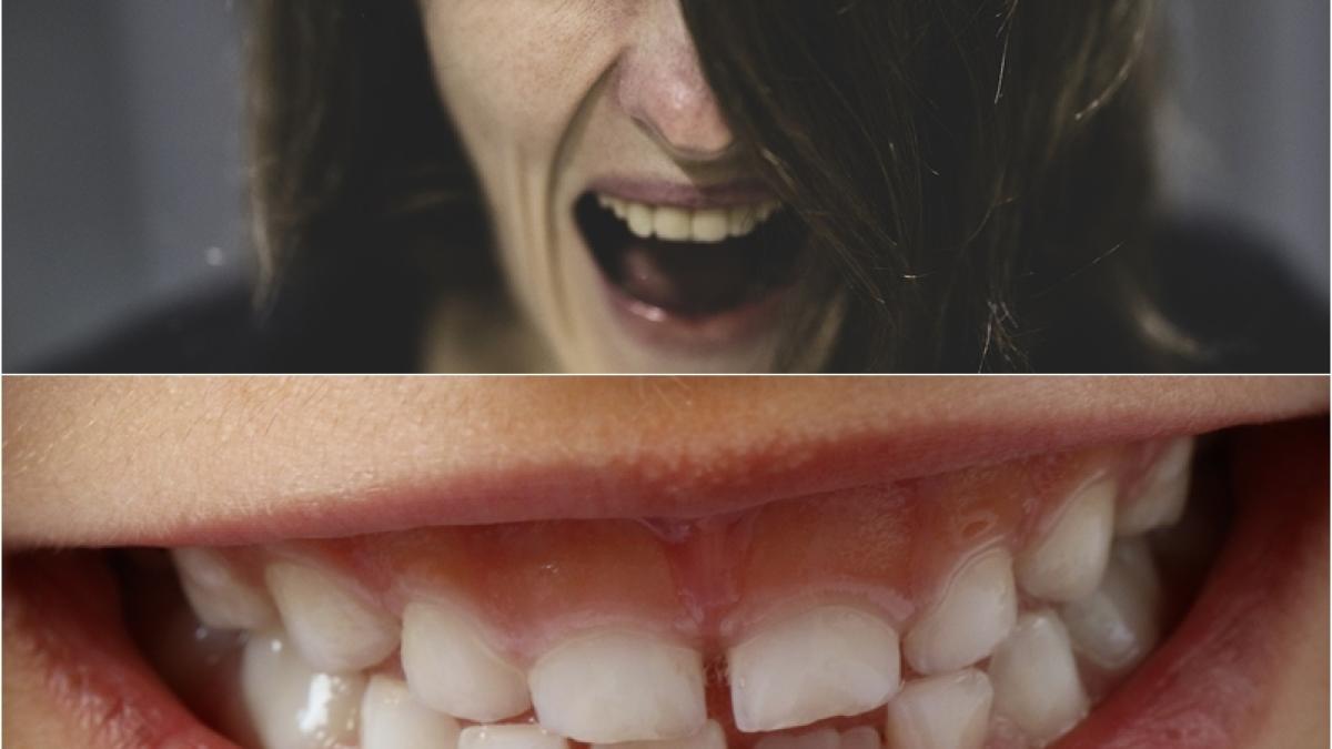 vis-dinti-rupti_17946500