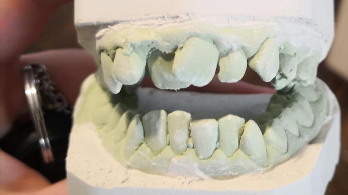 aparat-dentar-2_70240600