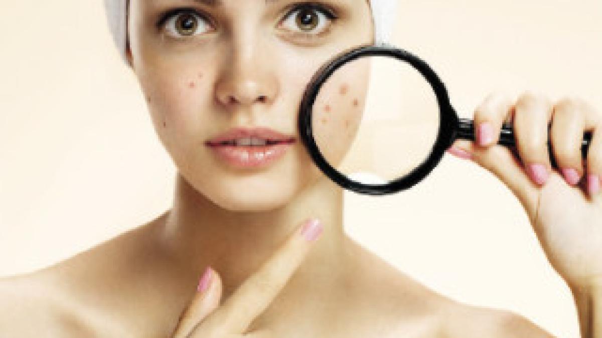 control-piele-dermatolog_22335700