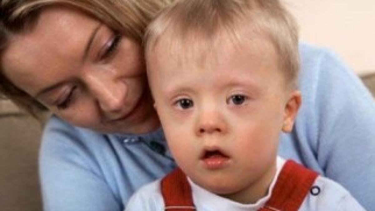 sindrom-down-dreamstime_4298665