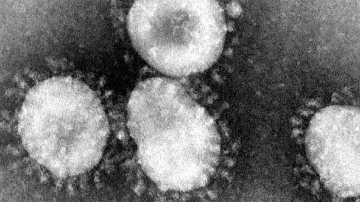 coronavirus_microscop_28188800