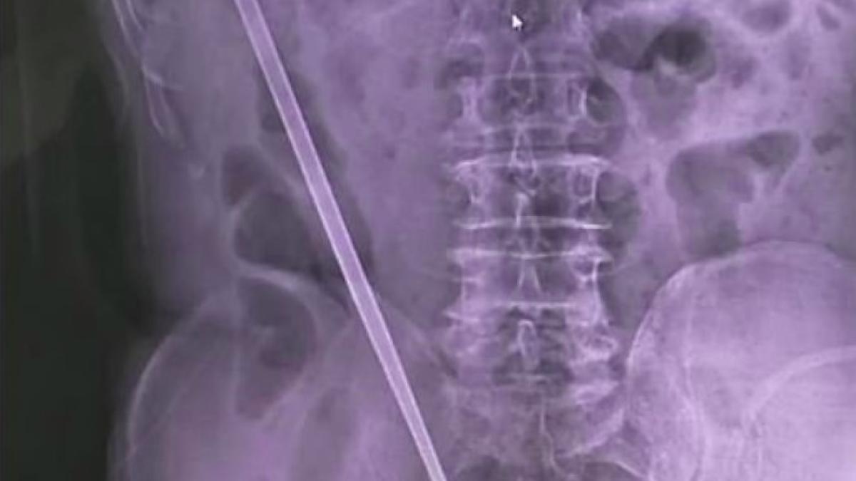 betigas_abdomen_38219400