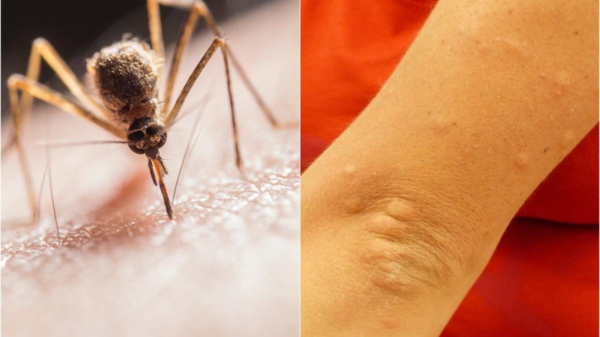 intepatura-tantar_05908200