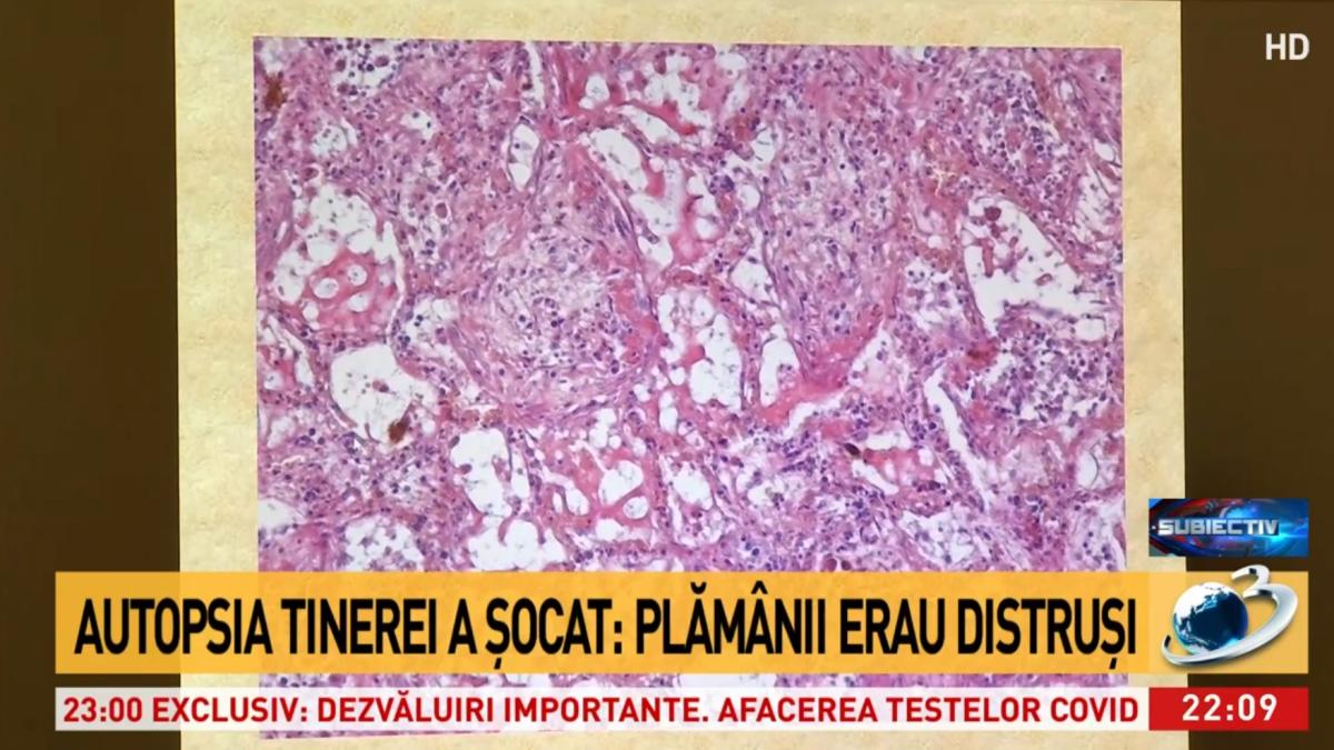 imagine-plamani_50924300