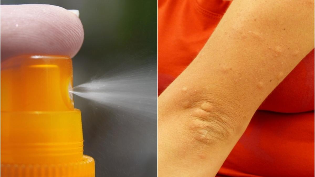 spray-tantari_95692300