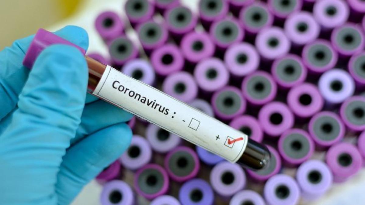 coronavirus_11347000