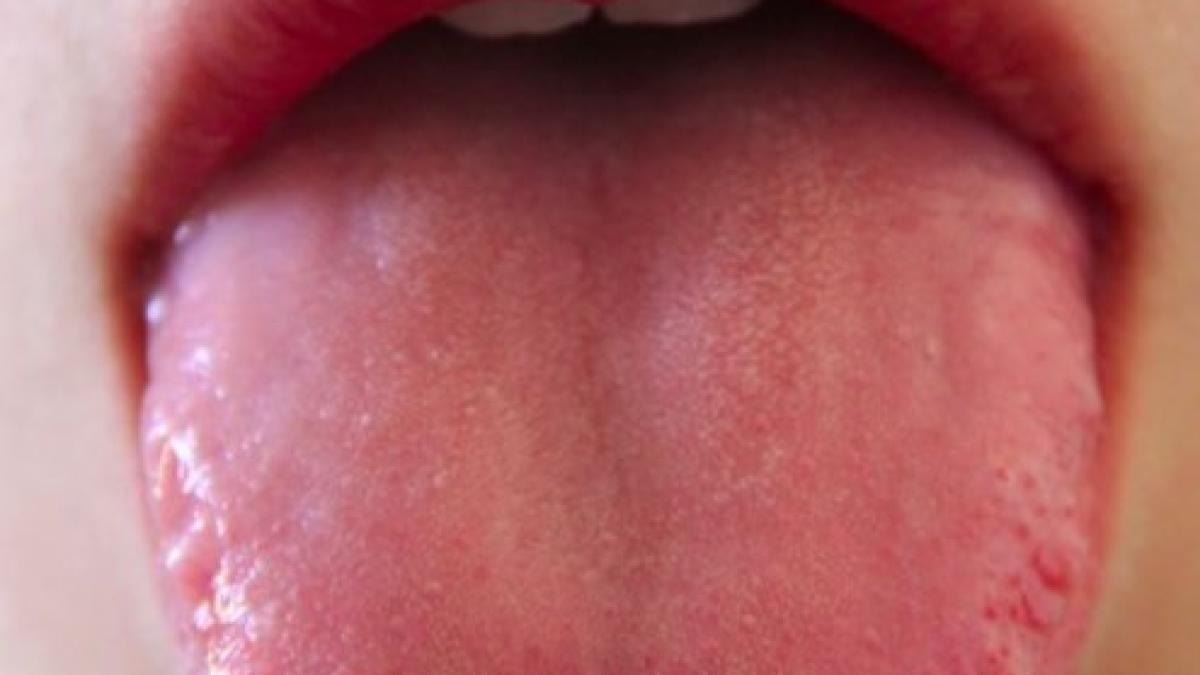 test_saliva_covid-19_68396800