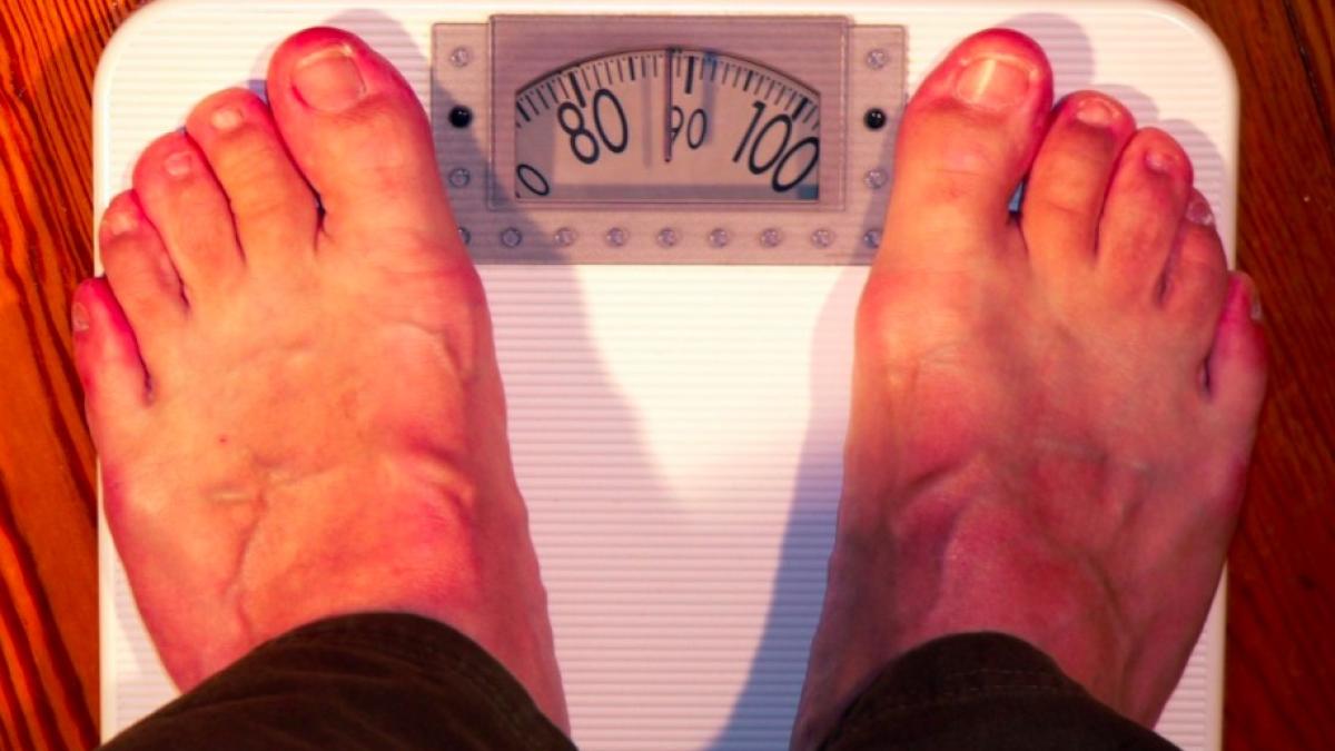 obezitate_greutate_apetit_studiu_clinic_76827200