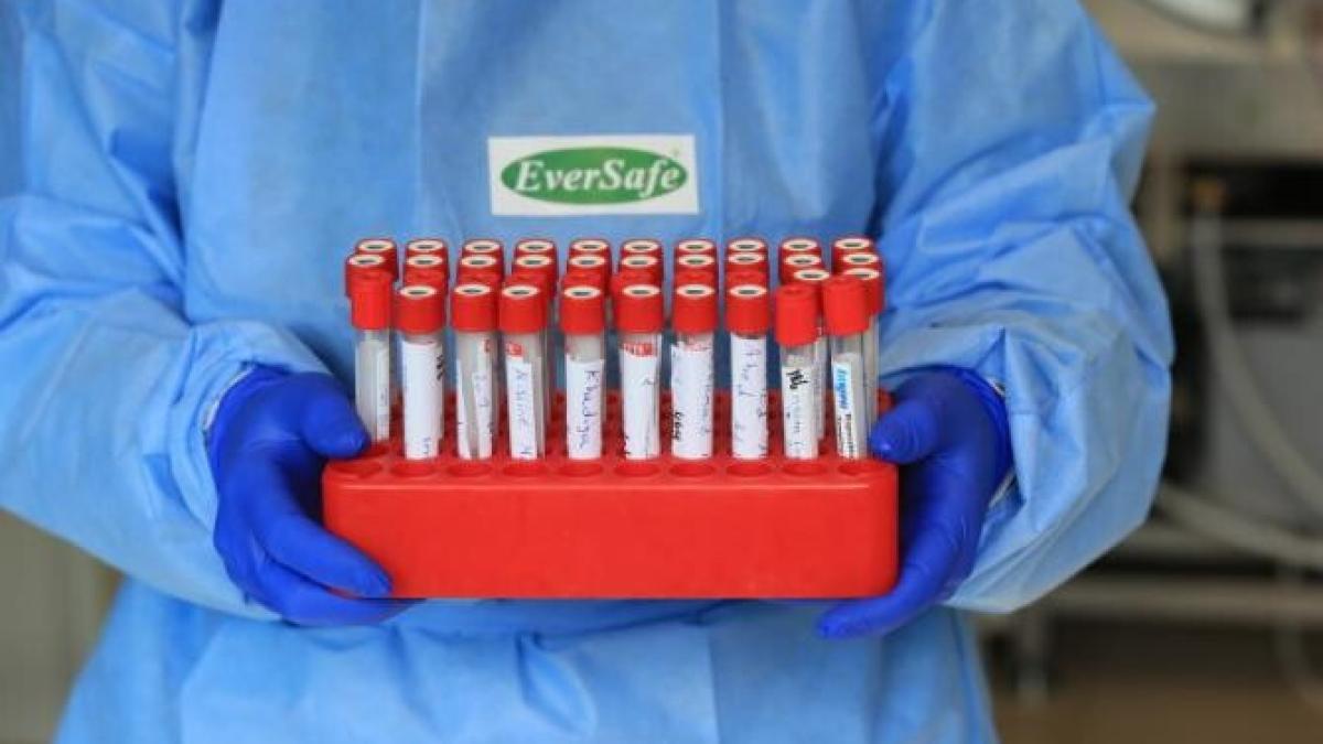 update-secretarul-general-al-onu-cere-intocmirea-unui-plan-mondial-de-vaccinare-impotriva-covid-19_41044100