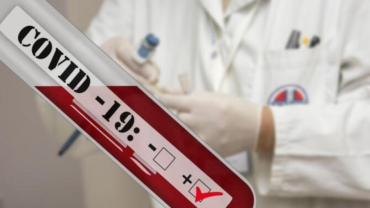 acadele-tip-test-anti-covid-19--introduse-iprc-ccprc-82n-graprc-ccprc-86dinitprc-ccprc-a6ele-din-austria_75734500