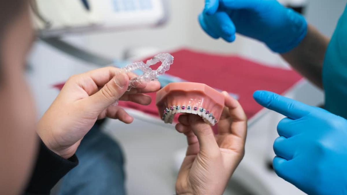 aparat-dentar_84395000