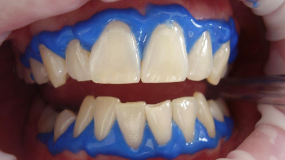 cum-sa-ti-albesti-dintii--remedii-naturale--la-indemana-si-ieftine-coaja-de-portocala--unul-dintre-secrete_29737300