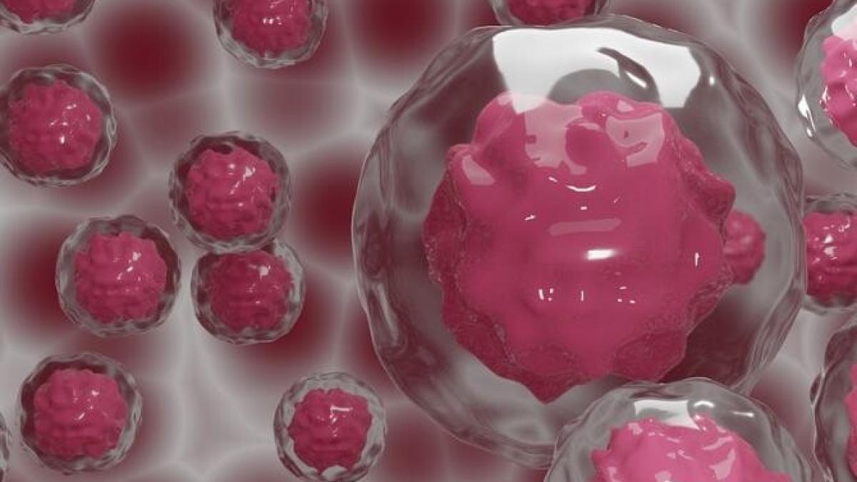 peste-81-000-de-donatori-de-celule-stem-iprc-ccprc-82n-romaprc-ccprc-82nia_62694100