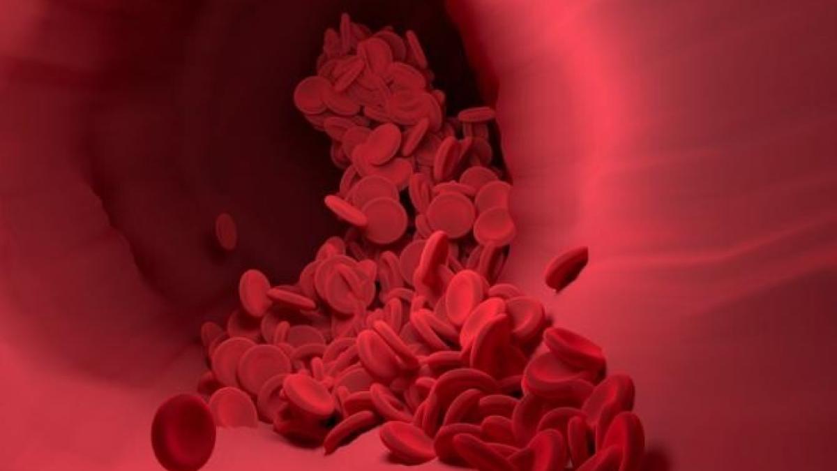 colesterolul-ridicat-hraprc-ccprc-86nesprc-ccprc-a6te-tumorile-sprc-ccprc-a6i-oferaprc-ccprc-86-rezistentprc-ccprc-a7aprc-ccprc-86-celulelor-canceroase_10068200