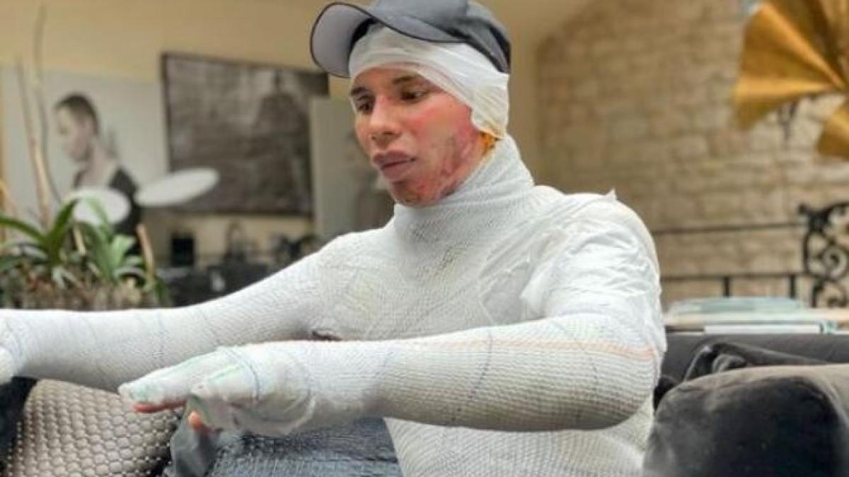 roustening-a-rs_02298500