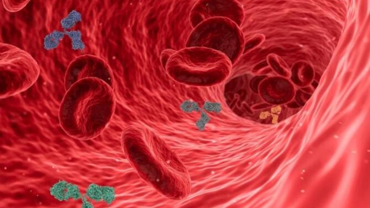 anticorpii-monoclonali--eficientprc-ccprc-a6aprc-ccprc-86-maximaprc-ccprc-86_98671900