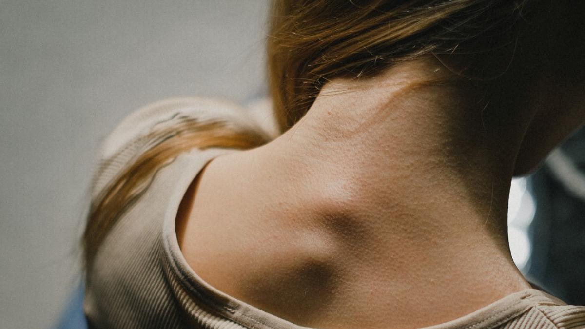 spondiloza-cervicala_23618100