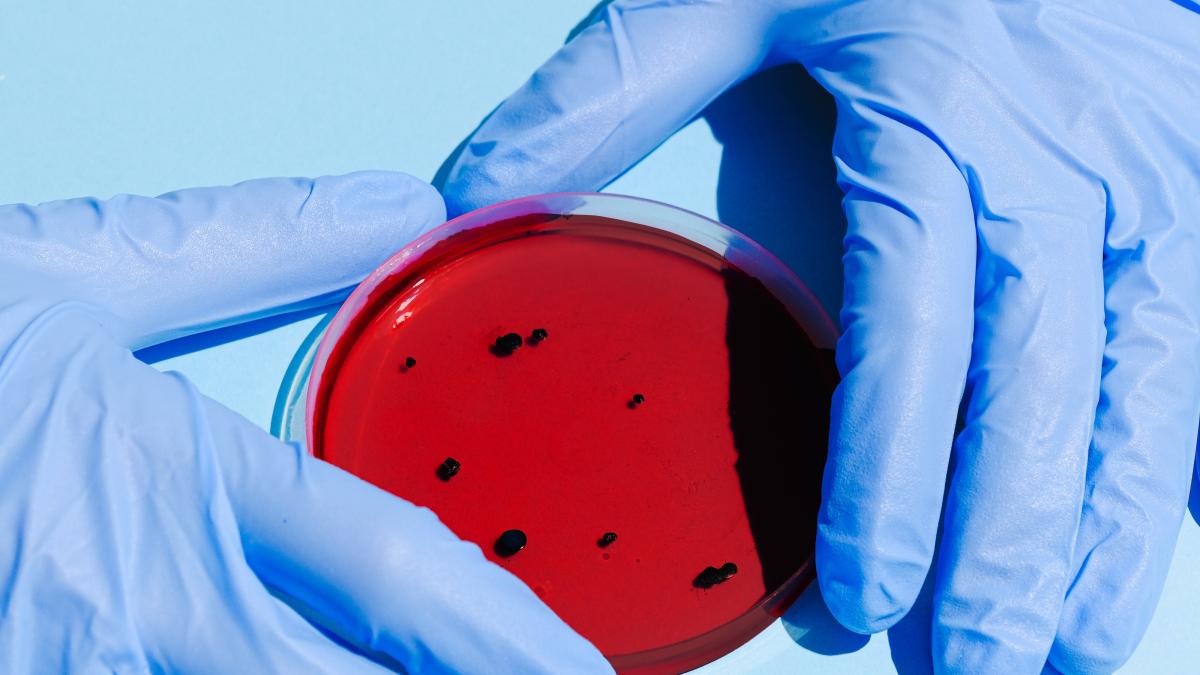 bacterii-pexels-anna-shvets-3786217_27768500