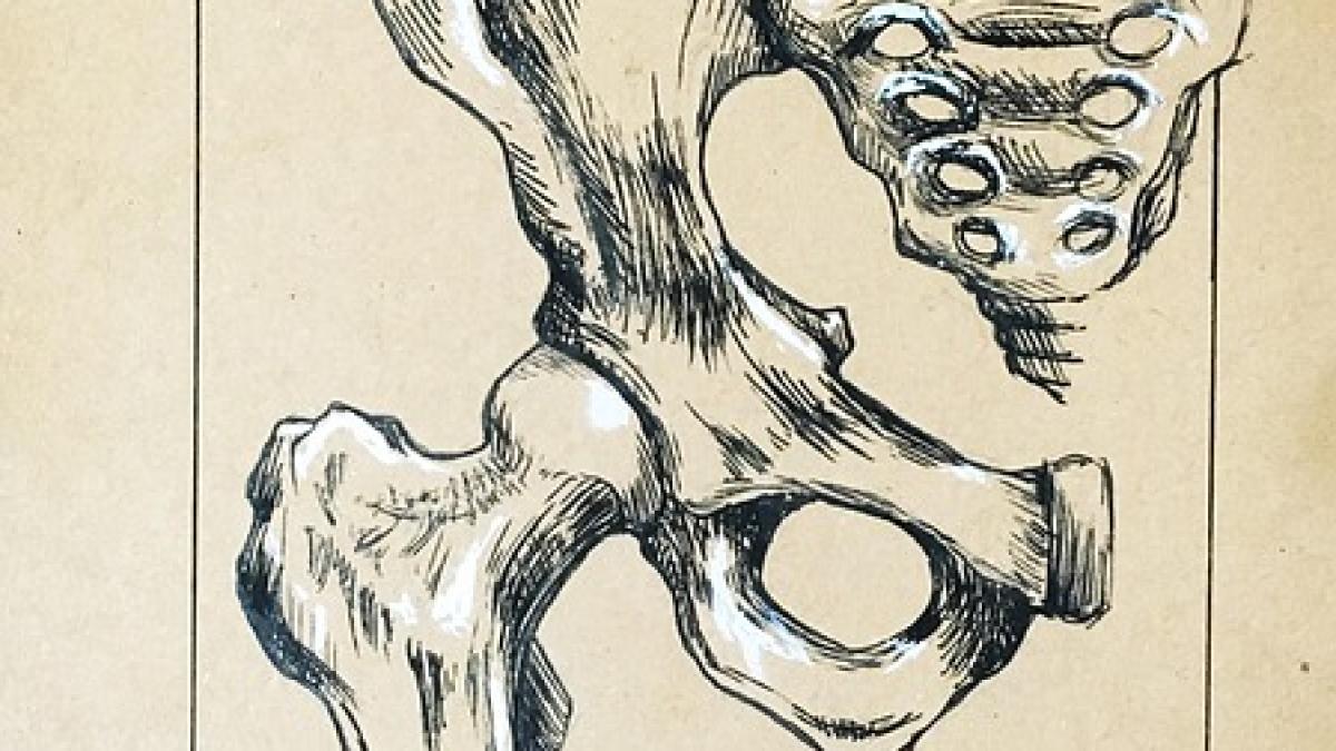 reconstructia-pelvina_04315700