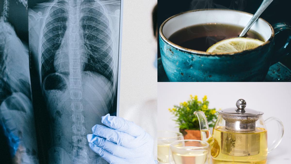 bautura-minune-care-curata-si-vindeca-plamanii-si-calmeaza-tusea--efect-antiinflamator--daca-te-ai-lasat-de-fumat--trebuie-sa-o-bei_01973500