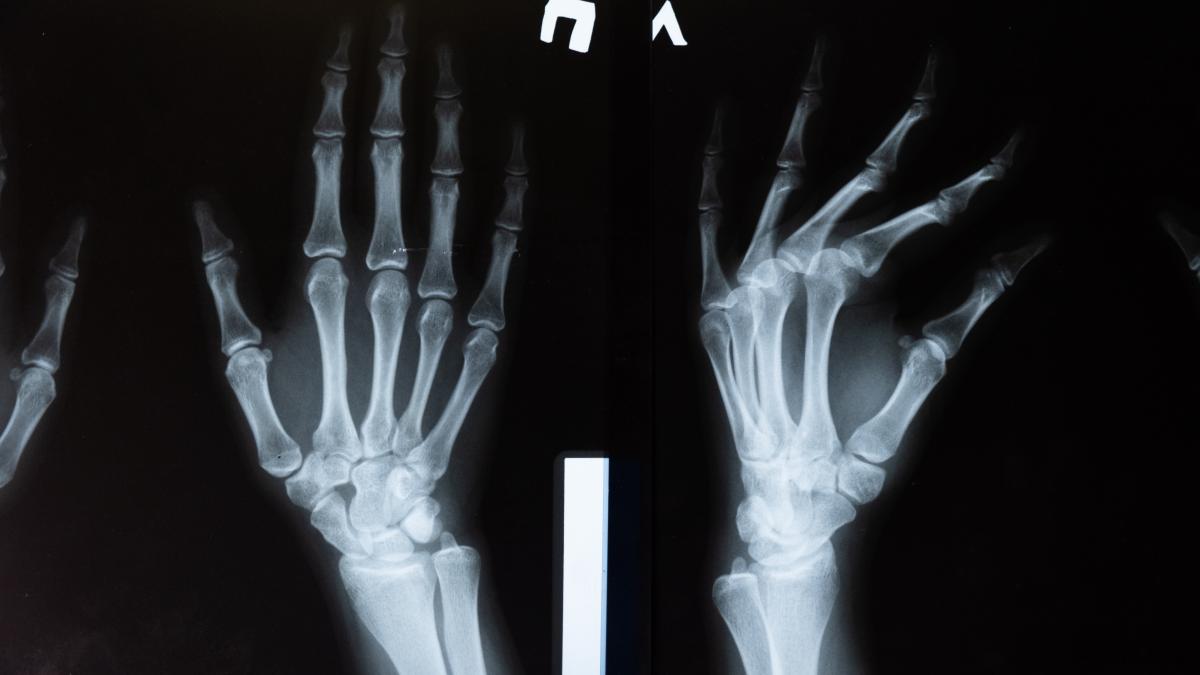 supravietuitoare_bataclan_nft_radiografie_pxl_87828800