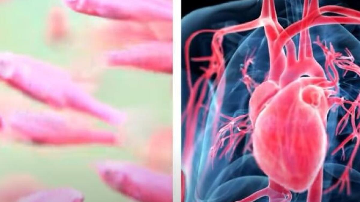 peste-robot_99857300