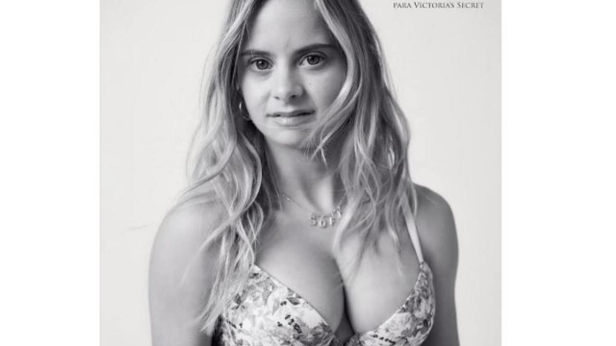 model-sindrom-down_62893100