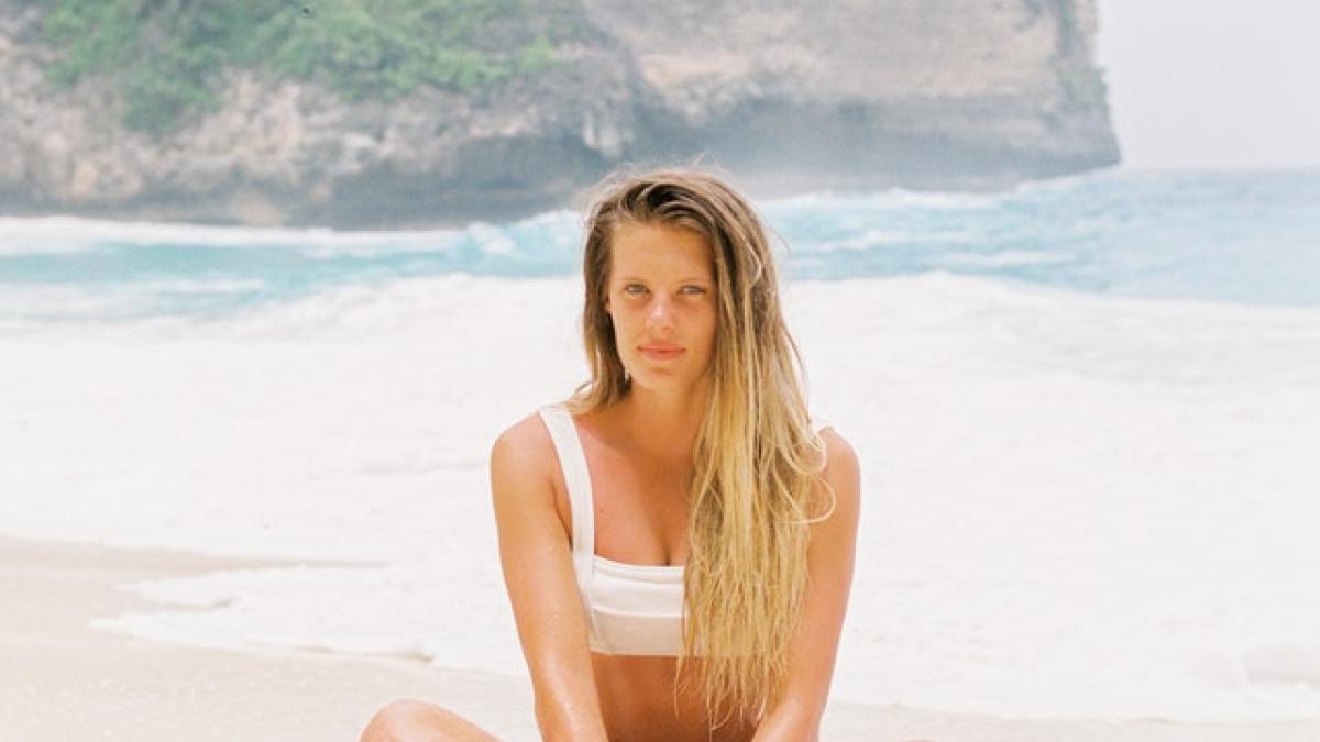 afectiuni-piele-soare_61999800