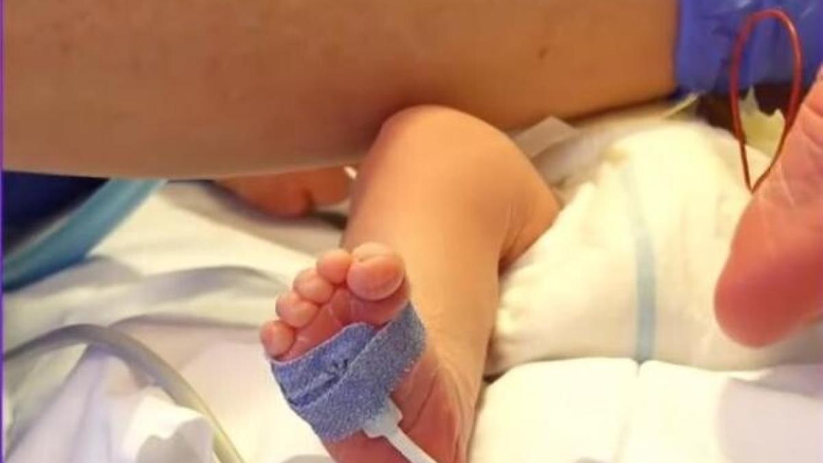 prematur-incubator_41733900